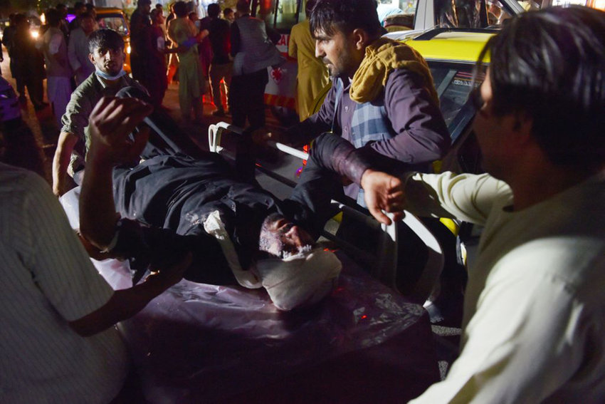 Medical and hospital staff bring an injured man on a stretcher for treatment after two blasts, which killed at least five and wounded a dozen, outside the airport in Kabul on August 26, 2021. (Wakil Kohsar/AFP via Getty Images/TNS)