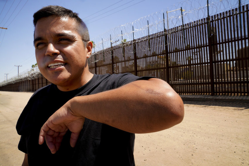Jose Andrez Lopez, 37 shows the scar on his arm he says was from the incident with a customs agent on Friday, April 23, 2021, in Calexico, California. Back in 2019, Lopez was crossing the border from Mexicali to Calexico, when he alleges the customs agent asked him to step out of the car and when he did he was forcibly pushed to the ground and handcuffed. The incident caused him facial cuts as well as cuts to his arms. He was eventually released without charges. (Nelvin C. Cepeda/San Diego Union-Tribune/TNS)