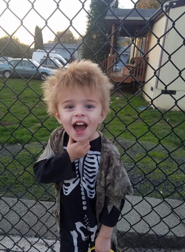 Zander, 7, of Toledo, was born with relatively normal hair that, due to uncombable hair syndrome, became wild and untamable as he grew older.